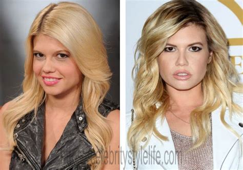 been on chanel west coast|chanel west coast before surgery.